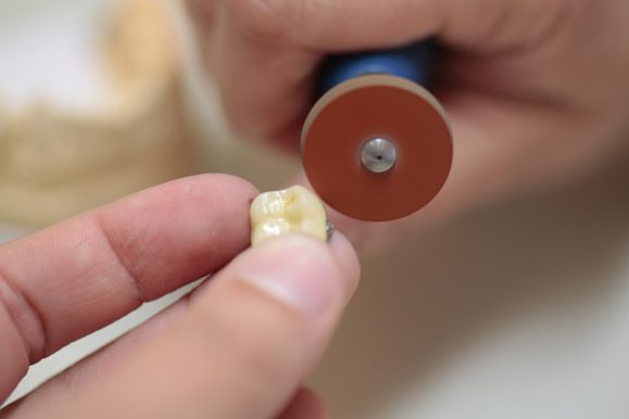Dentaltechnik Bracher - Impressionen aus dem Labor